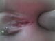 Private Photo of holebouche